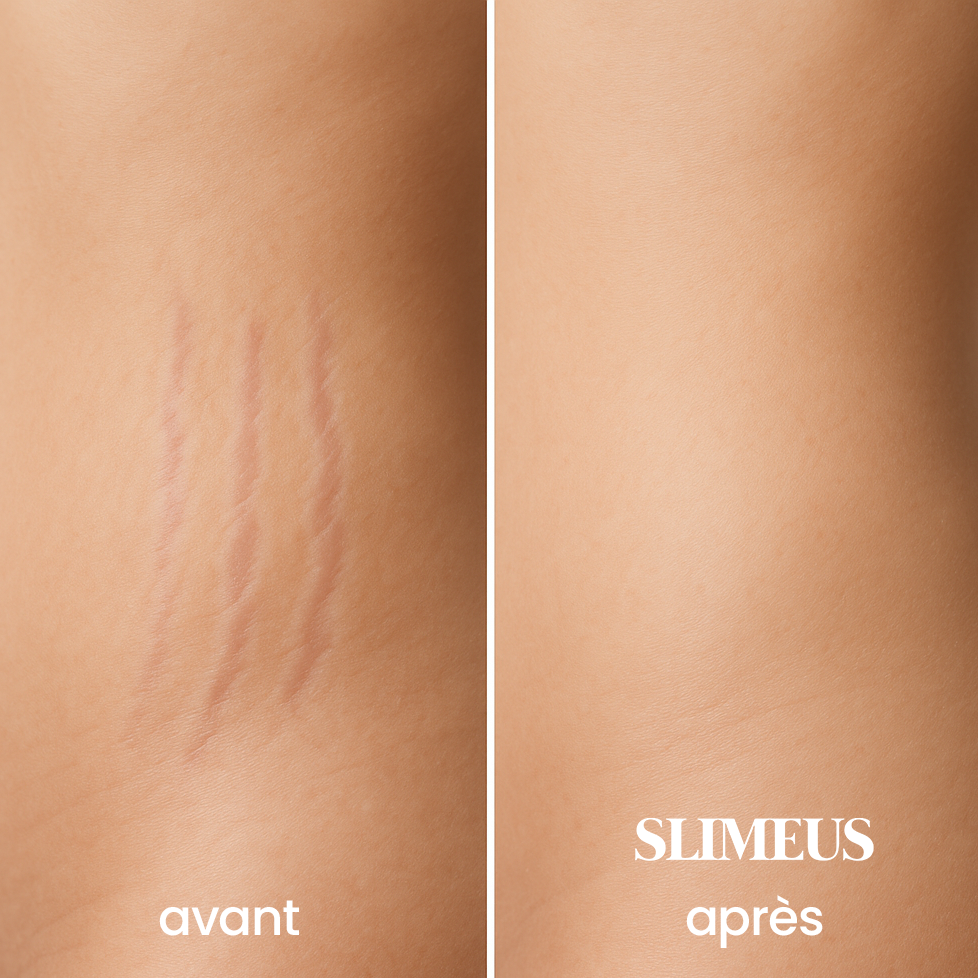 Slimeus (By ADEUS) -Crème minceur & vergeture